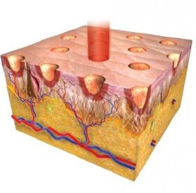 Epidermă