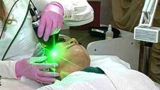 pro și contra de întinerire a pielii faciale laser