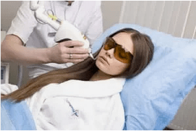 Întinerire fracționată cu laser