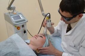 procedura cu laser de întinerire a pielii faciale